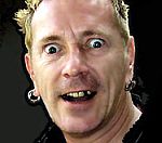 Sex Pistols John Lydon Has 'Rotten' Teeth Fixed