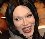 Pete Burns 'Critically Ill', Undergoes 5 Hour Operation